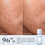 Press & Clear Nachfüllpackung™