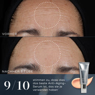  Image avant et après d'un front montrant une réduction des rides après l'utilisation de Medik8 Crystal Retinal. 