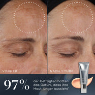 Vorher-Nachher-Vergleich einer Hautbehandlung mit einer Cremetube auf blauem Hintergrund.