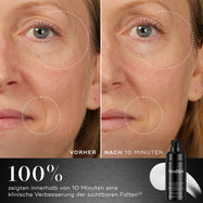 Der Vorher-Nachher-Vergleich 10 Minuten zeigt die Augenpartie und den Lachbereich einer Person und veranschaulicht eine Reduzierung der sichtbaren Falten. Unter den Bildern heißt es: „Klinisch erwiesen: Verbessert das Erscheinungsbild tiefer Falten in 8 Wochen.“