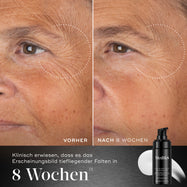 Der Vergleich vor und nach 8 Wochen zeigt die Augen- und Wangenpartie einer Person und veranschaulicht die Reduzierung tiefer Falten. Unter den Bildern steht: „Klinisch erwiesen: Verbessert das Erscheinungsbild tiefer Falten in 8 Wochen.“