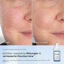 Niacinamide Peptides™